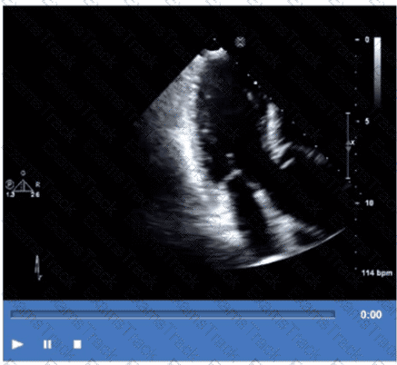 AE-Adult-Echocardiography Question 35
