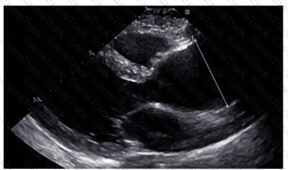 AE-Adult-Echocardiography Question 2
