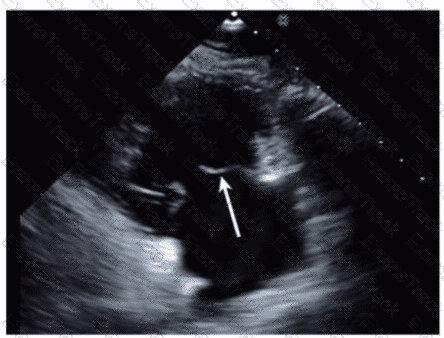 AE-Adult-Echocardiography Question 27