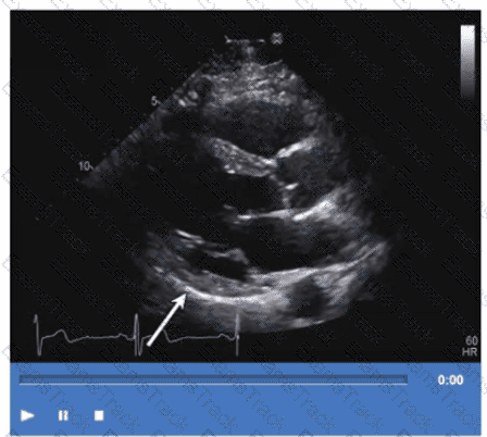 AE-Adult-Echocardiography Question 41