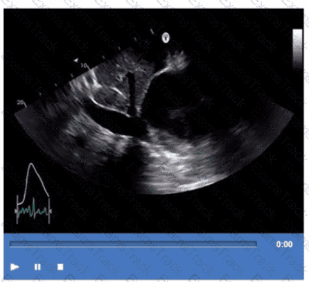 AE-Adult-Echocardiography Question 10