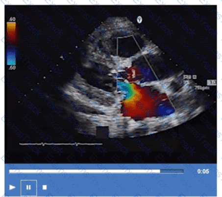 AE-Adult-Echocardiography Question 38