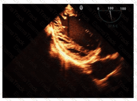AE-Adult-Echocardiography Question 36