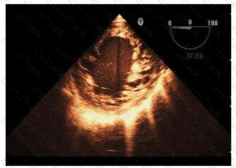 AE-Adult-Echocardiography Question 36